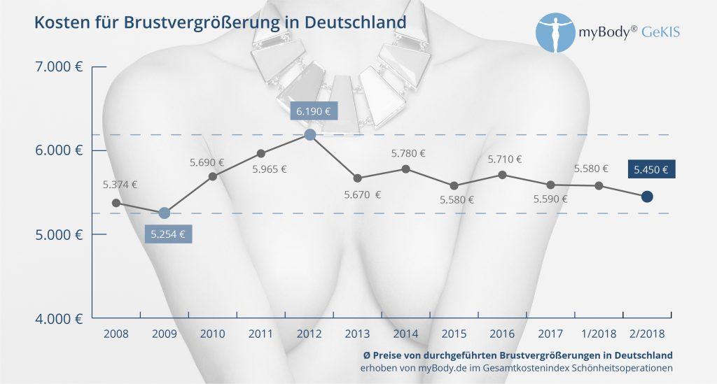 Kosten für Brustvergrößerung - GEKIS-INdex