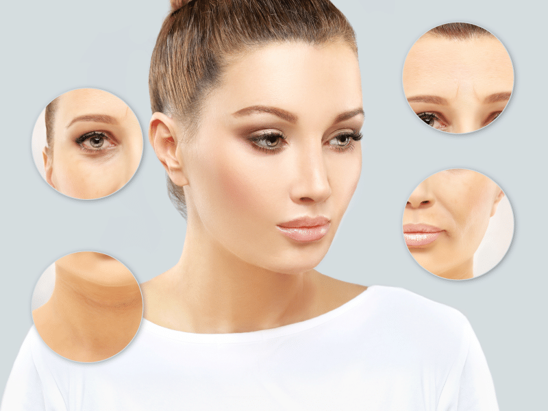 Welche Gesichtsareale können mit Botox behandelt werden?