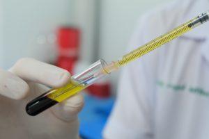 prp therapie was ist es Spritze mit Fluessigkeit auffuellen